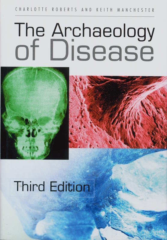 The archaeology of disease / Charlotte Roberts and Keith Manchester cover