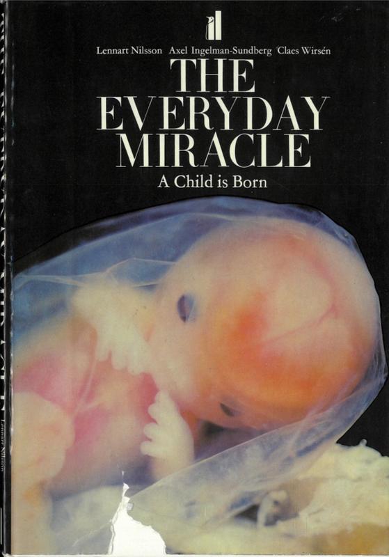 The everyday miracle : a child is born / photographs, Lennart Nilsson ; text, Axel Ingelman-Sundberg, Claes Wirsén cover