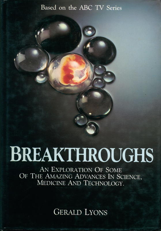 Breakthroughs : an exploration of some of the amazing advances in science, medicine and technology / Gerald Lyons cover