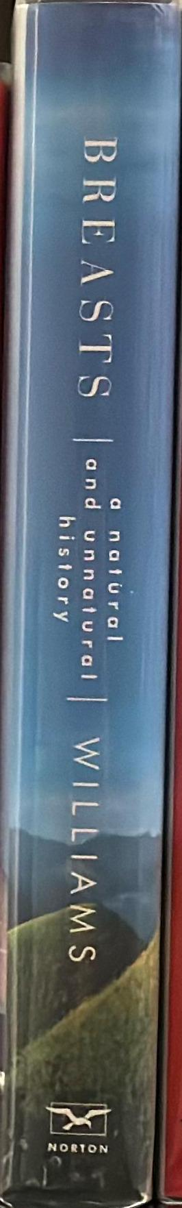 Breasts : a natural and unnatural history spine