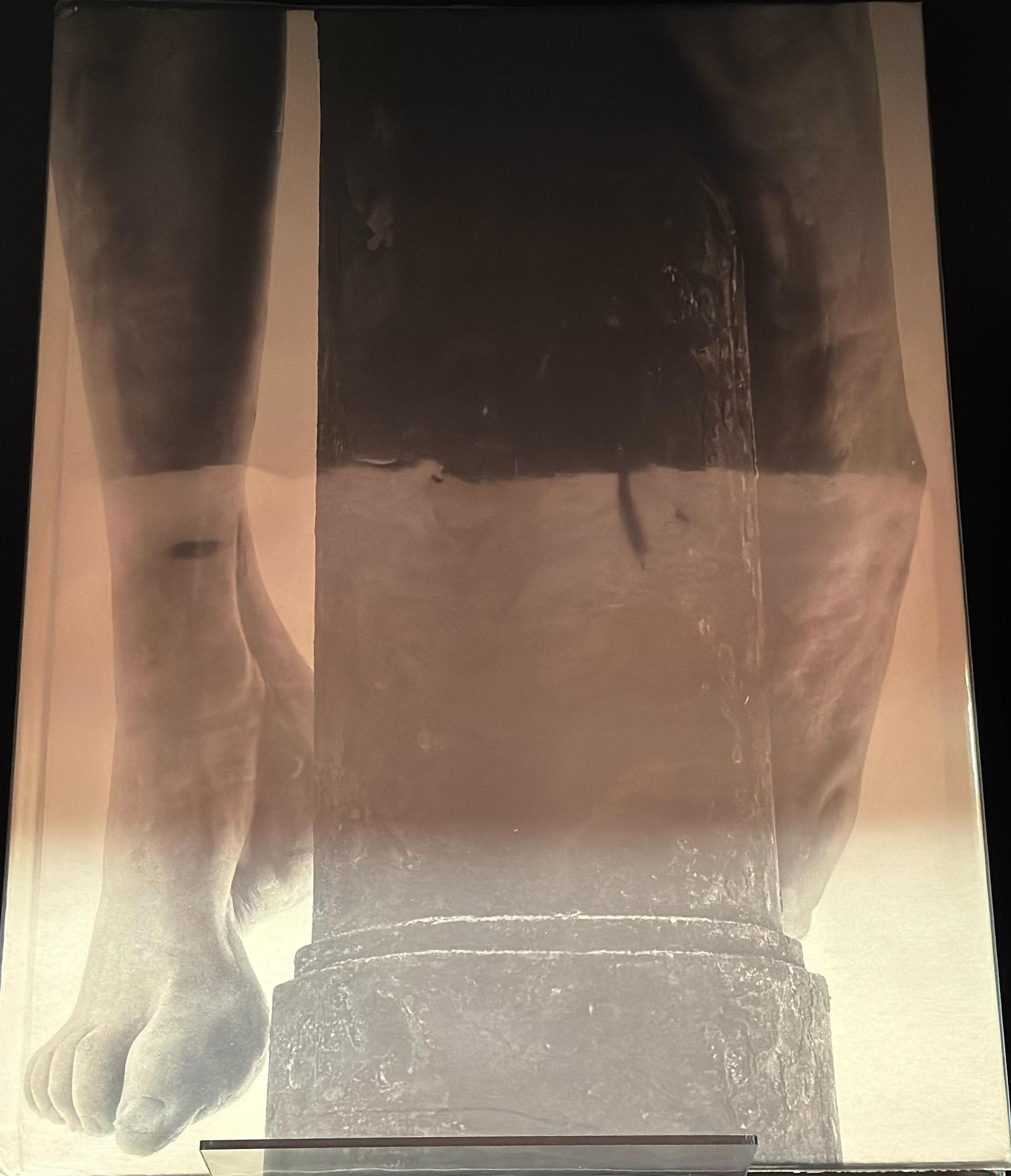 Schmerzensmann / Berlinde De Bruyckere spine