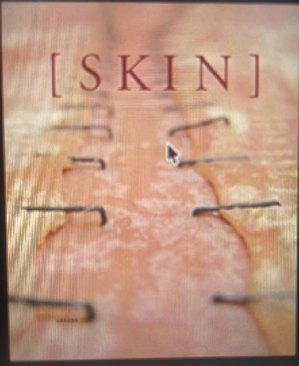 [Skin] / Heide Hatry ; with contributions by Michael J. Amy [and 8 others] live cover