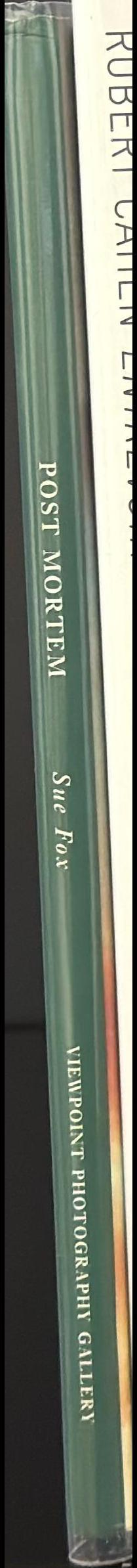 Post mortem spine